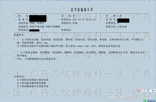乳腺癌术后需要化疗吗广东药科大学广州复星禅诚医院肿瘤一区(图1)