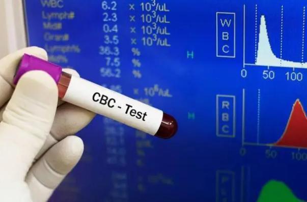 血常规真的能查出癌症吗?医生说出实情看完涨知识了(图1)