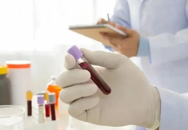 血常规真的能查出癌症吗?医生说出实情看完涨知识了(图3)