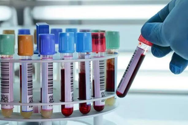 血常规真的能查出癌症吗?医生说出实情看完涨知识了(图8)