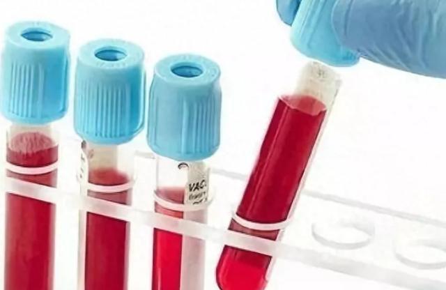 血常规真的能查出癌症吗?医生说出实情看完涨知识了(图5)