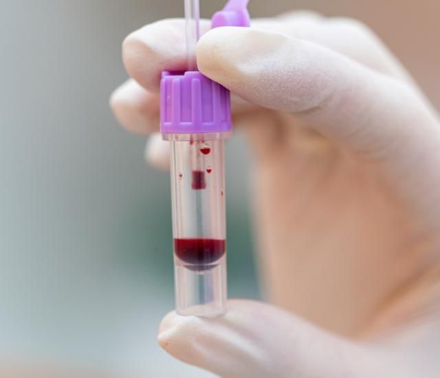 血常规真的能查出癌症吗?医生说出实情看完涨知识了(图9)