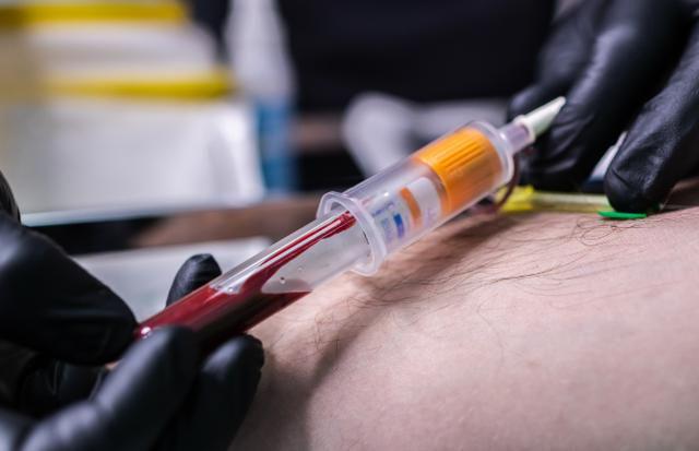 血常规真的能查出癌症吗?医生说出实情看完涨知识了(图10)