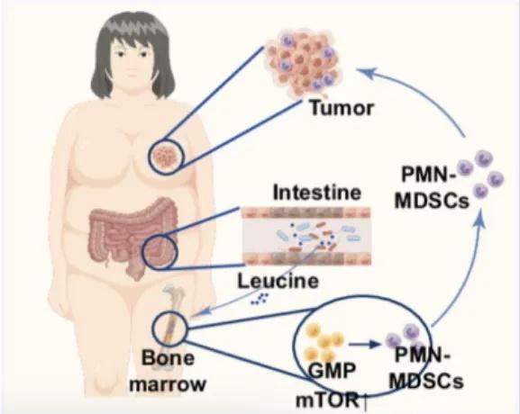 被胃癌盯上的中国人最喜欢这样吃饭…警惕“三高”饮食习惯！(图1)