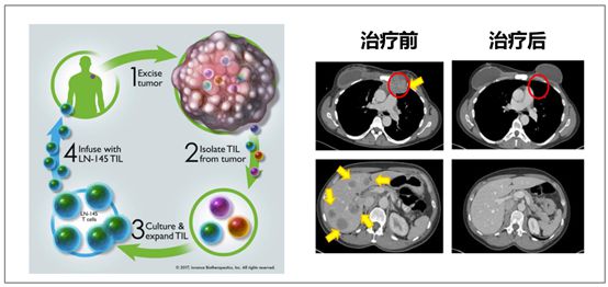 菠萝：肿瘤免疫疗法哪些靠谱？哪些是忽悠？(图4)