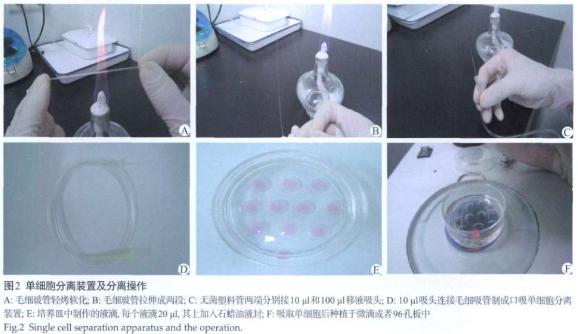 单个肿瘤干细胞分离及其培养实验的方法(图2)