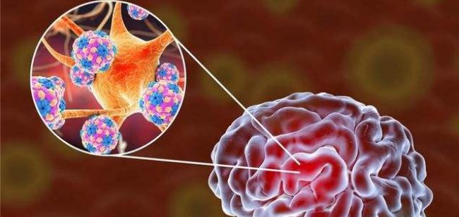 日本脑炎病毒在澳大利亚疯传科学家发现其可能导致致命脑部感染(图1)