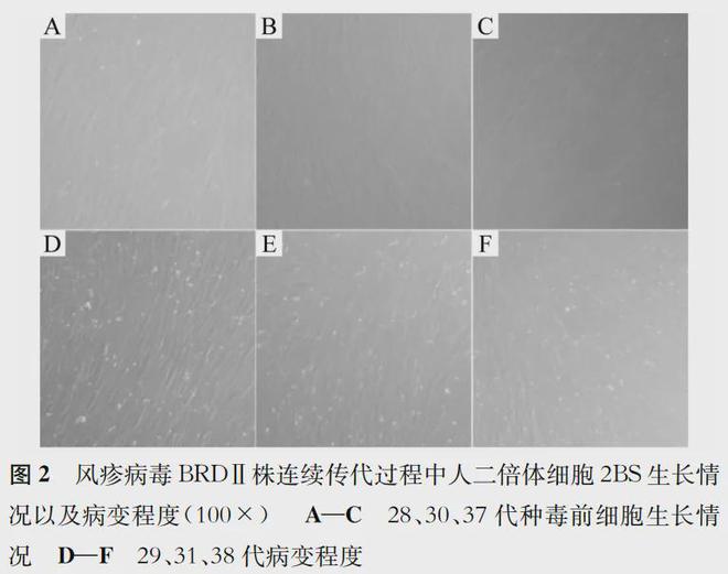 疫苗前沿风疹病毒BRDⅡ减毒株E1区连续传代稳定性研究(图3)