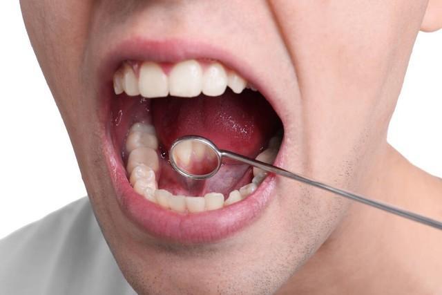 癌症来临看牙齿能知道？告诫：患癌症的人牙齿出现这几个症状(图2)