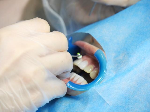 癌症来临看牙齿能知道？告诫：患癌症的人牙齿出现这几个症状(图11)