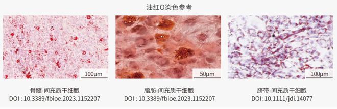 一文概述间充质干细胞(MSC)的三系分化及其培养Protocol(图5)