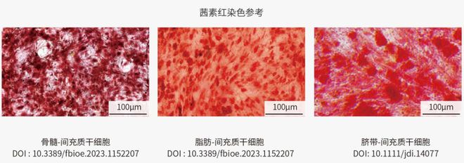 一文概述间充质干细胞(MSC)的三系分化及其培养Protocol(图3)