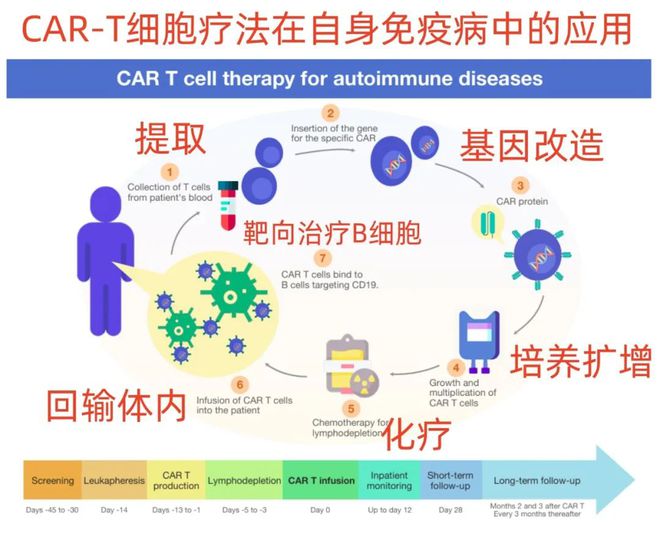 治愈曙光！CAR-T细胞疗法成功用于8位狼疮肾炎患者尿蛋白消失免疫抑制剂全部停药(图3)