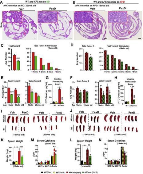 管住口从现在开始！cell+cellrepors研究表明：高脂肪饮食会影响肠道微生物以及代谢加剧患癌风险！(图5)