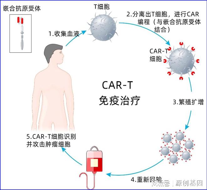 免疫细胞疗法：癌症治疗的新革命(图3)