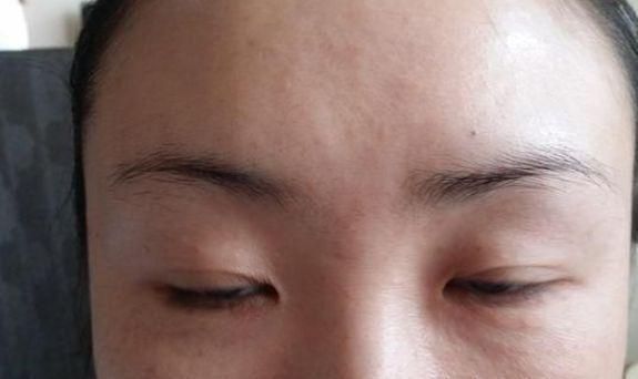 拿大蒜在眉毛上擦两下会有什么好处？马上告诉你答案(图5)