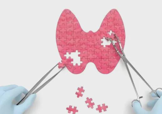 切除甲状腺对身体有影响吗？医生：要做好术后生活管理(图1)