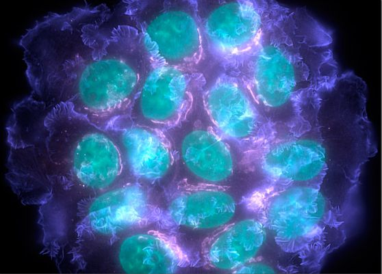 有的人得一种癌症就马上去世了？有的人却得了十几种癌症还很健康(图4)