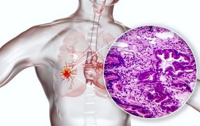 癌症患者有救了！国产治癌机出世无痛治疗超1500名患者已治疗(图2)