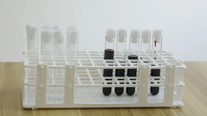 癌症患者呈现两极分化趋势的今天建议多了解这2个防癌重点(图3)