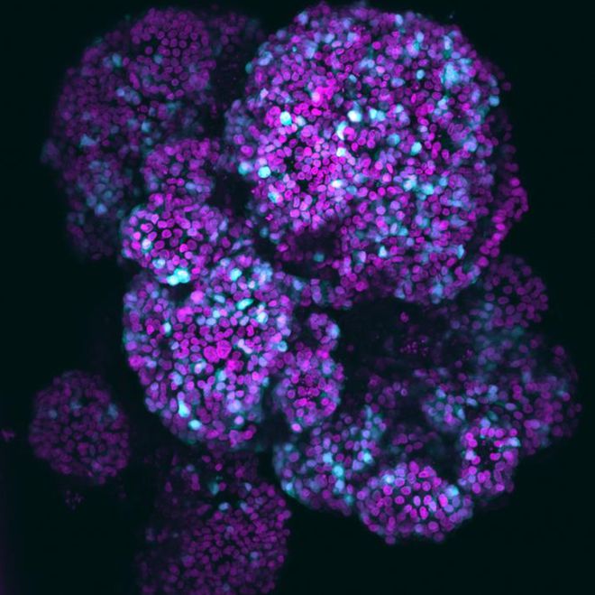 类器官之父最新Cell：成功创建包含所有关键胰腺细胞的新型类器官(图3)