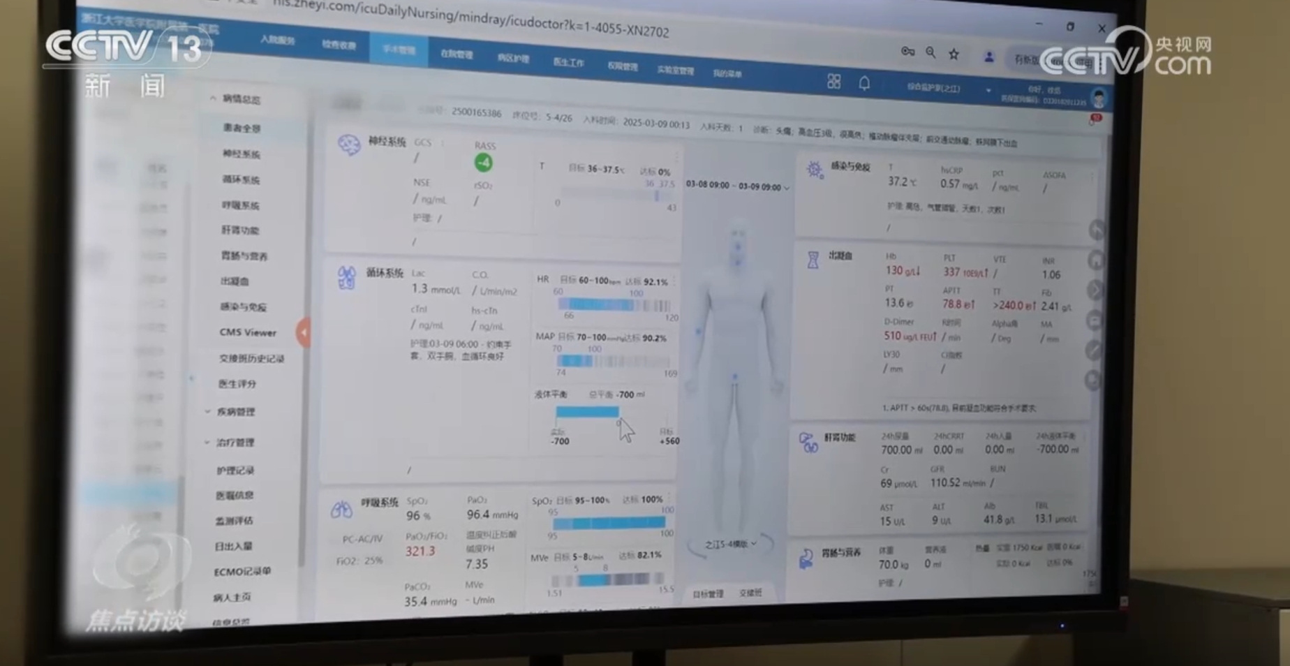 焦点访谈｜更快、更准、更智能AI技术正掀起医疗变革(图4)