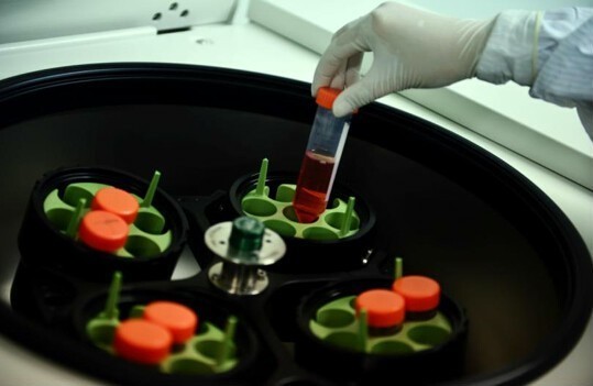 深耕生命科学领域干细胞、基因技术双轮驱动——银丰生物集团绘就健康产业蓝图(图2)