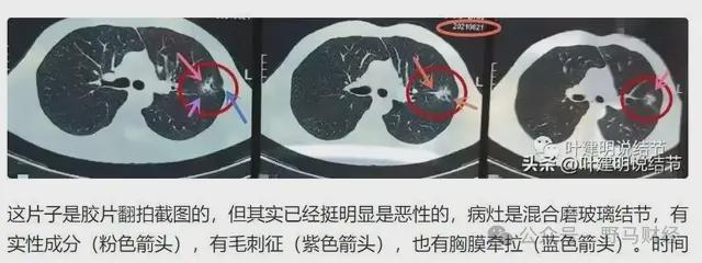 爱康国宾二次声明“漏癌”无责女律师发出7大灵魂拷问！(图6)