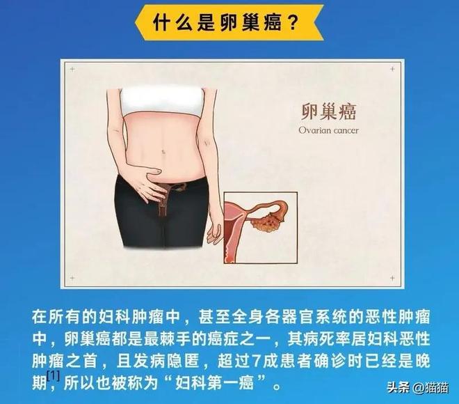 朱媛媛病因曝光是一种被称为妇科肿瘤“死亡率第一杀手”的癌症(图3)