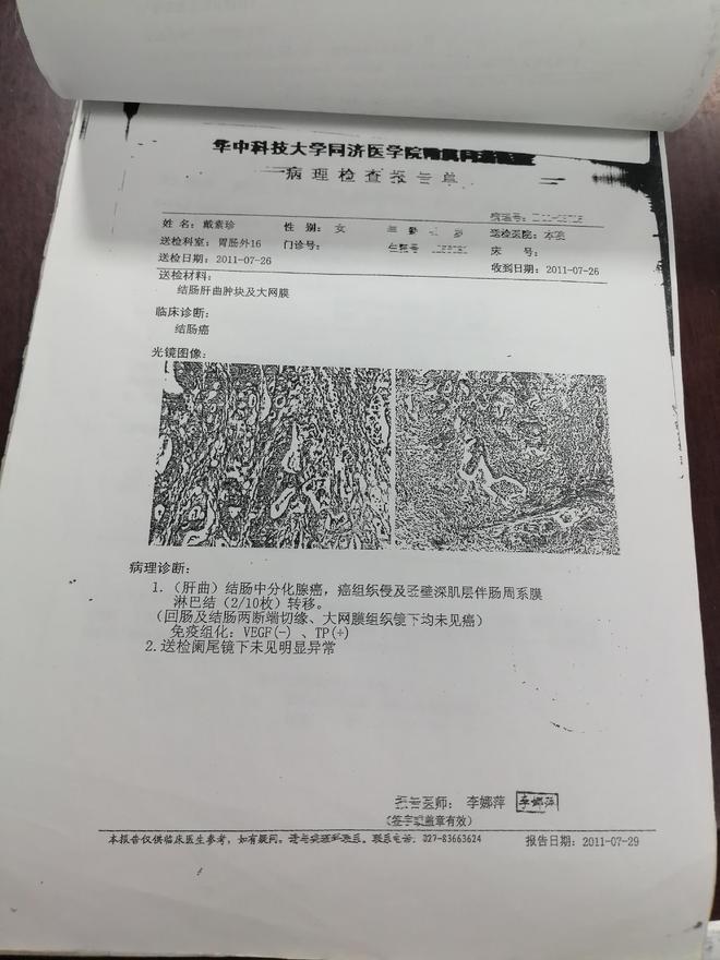 “活不过2年！”同济曾下断言她却硬扛13年改写抗癌生存期(图2)