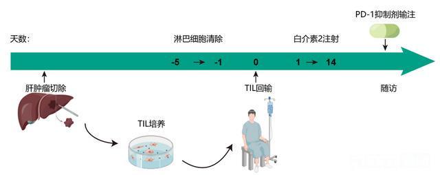 全球首创！同济医院肝癌细胞新疗法问世晚期患者3年无复发(图2)