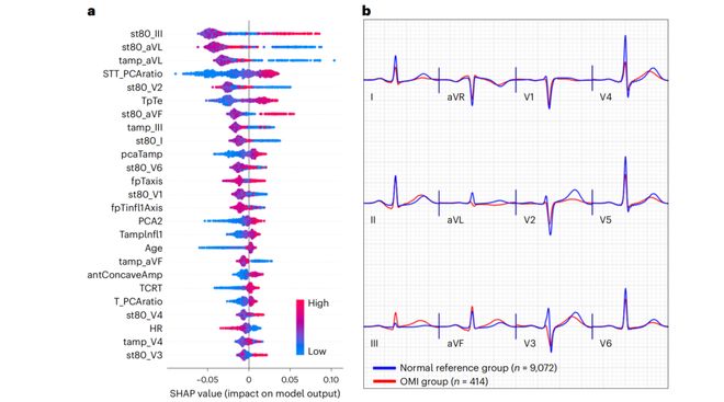 两篇NatureMedicine解读机器学习+特征筛选+模型解释(图3)