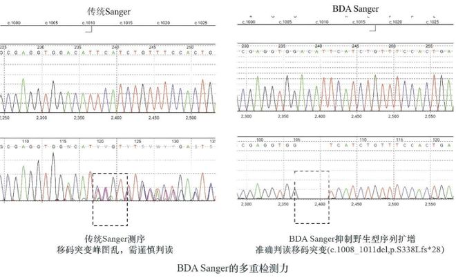 瑞金医术丨这项瑞金自主研发的检测技术大幅度提高罕见血液病的诊疗效率(图1)