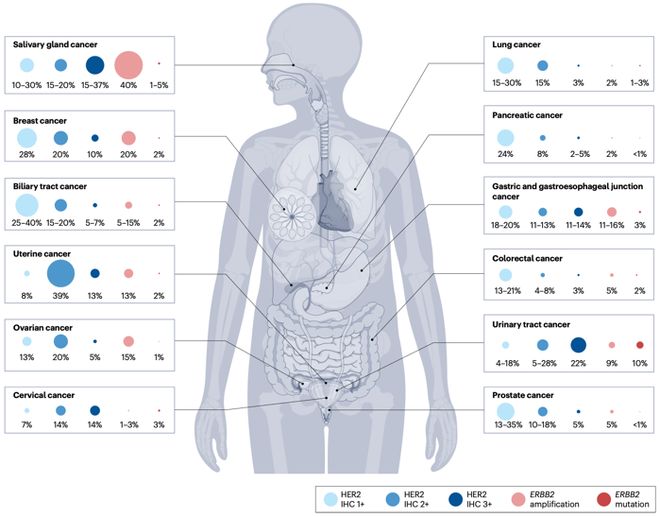MTB探讨：HER2阳性晚期肝内胆管癌治疗策略｜第45轮长征疑难肿瘤MTB会议(图5)