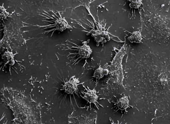 癌细胞是一种独立的生物吗？(图1)