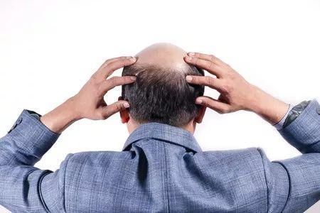 一次压力可能导致反复脱发！新研究揭秘：压力如何“种下祸根”？(图2)