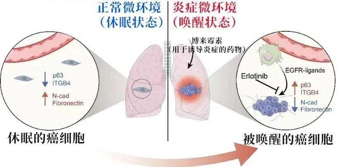 长期慢性炎症会“唤醒”癌细胞！降低体内慢性炎症水平的3个方法(图1)