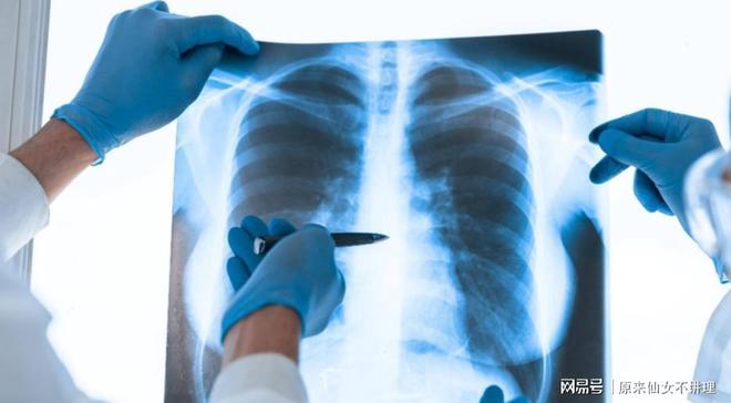 72岁肿瘤专家抗癌一年离世临终前的两个后悔引以为戒(图2)