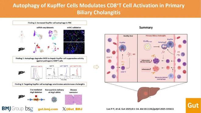 Gut丨廉哲雄李亮韩英团队揭示：Kupffer细胞自噬可能是原发性胆汁性胆管炎（PBC）治疗新靶点(图2)