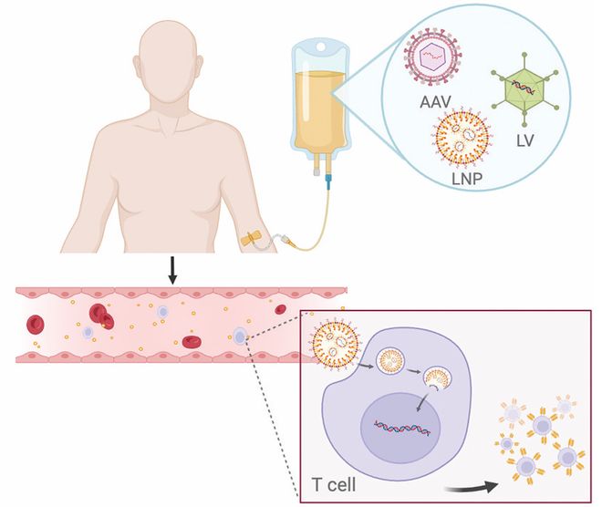 从“体外定制”到“体内生成”CAR-T疗法的下一个十年全解析(图2)