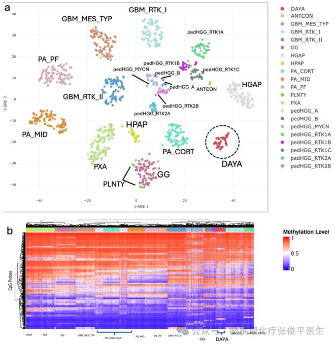 常伴有MAPK通路改变的青少年和年轻成人型弥漫性星形细胞瘤(图1)