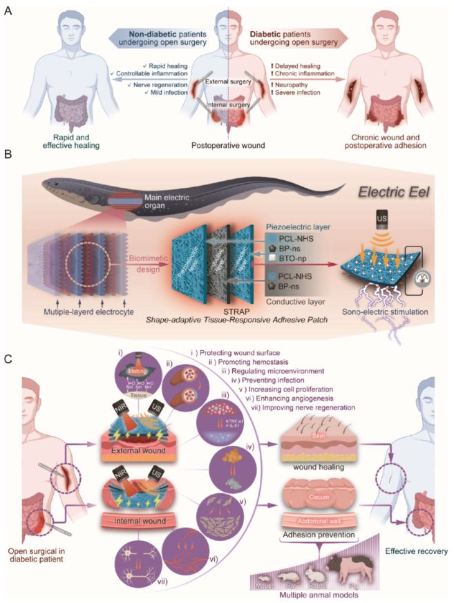 南京大学ACSNano：电鳗启发智能绷带问世促进糖尿病术后恢复(图3)