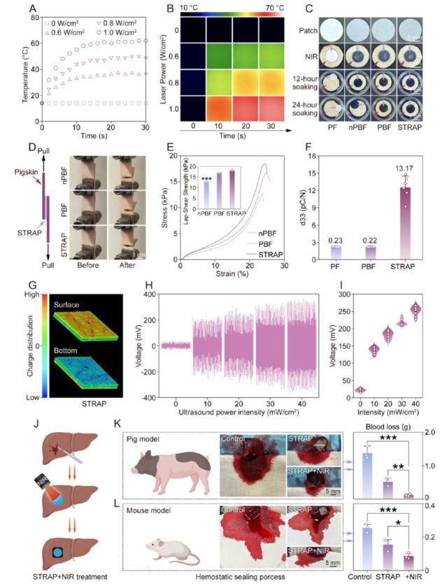 南京大学ACSNano：电鳗启发智能绷带问世促进糖尿病术后恢复(图5)