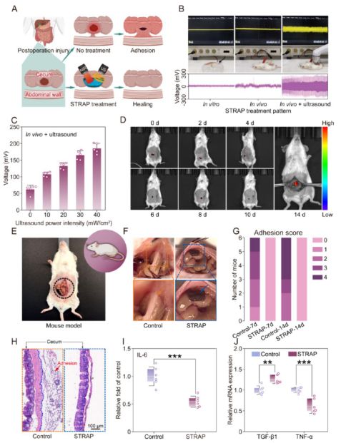 南京大学ACSNano：电鳗启发智能绷带问世促进糖尿病术后恢复(图9)