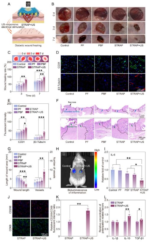 南京大学ACSNano：电鳗启发智能绷带问世促进糖尿病术后恢复(图7)