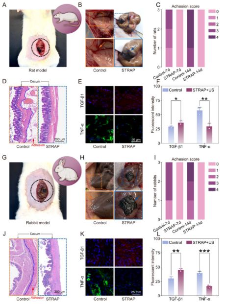 南京大学ACSNano：电鳗启发智能绷带问世促进糖尿病术后恢复(图10)