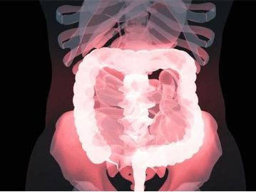 别等肠镜结果出来再后悔！今天开始守住你的三道“防癌线”(图1)