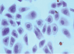 MTT作用原理(图1)